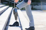 Bionic BioLeg